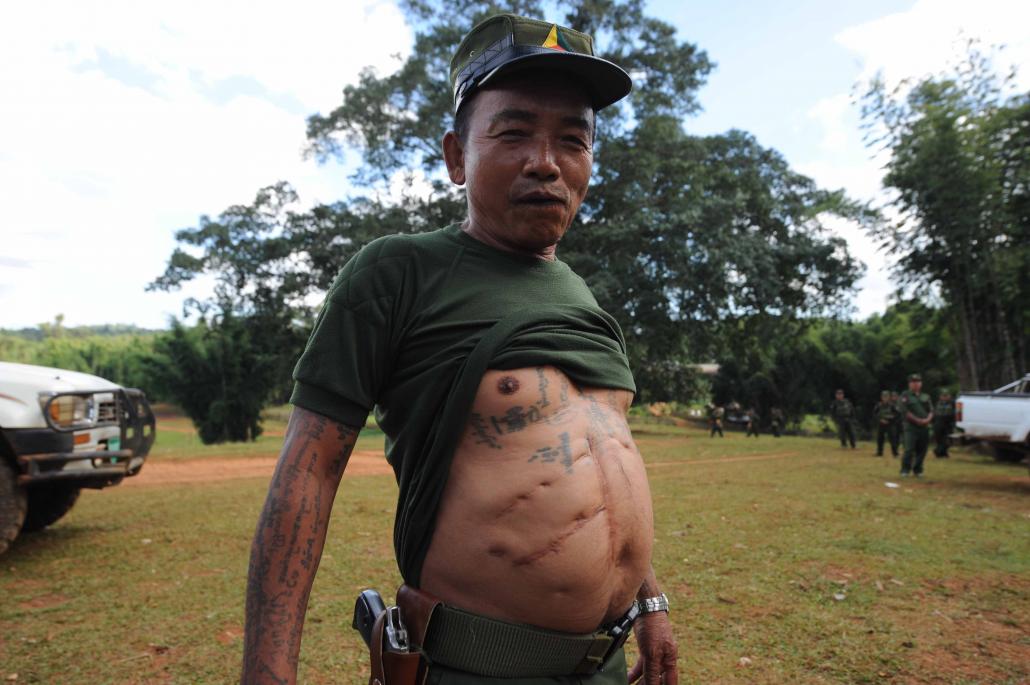 A veteran soldier from an ethnic armed group displays his numerous war injuries. (Steve Tickner / Frontier)