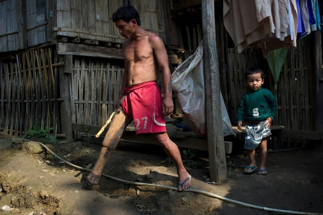 ထိုင်း-မြန်မာနယ်စပ်အနီး မဲဆောက်ဒေသမှ မယ်လဒုက္ခသည်စခန်းအတွင်း ခြေတုဖြင့်လျှောက်သွားနေသည့် မိုင်းထိဒုက္ခသည်တစ်ဦး။ ဓာတ်ပုံ - အေအက်ဖ်ပီ