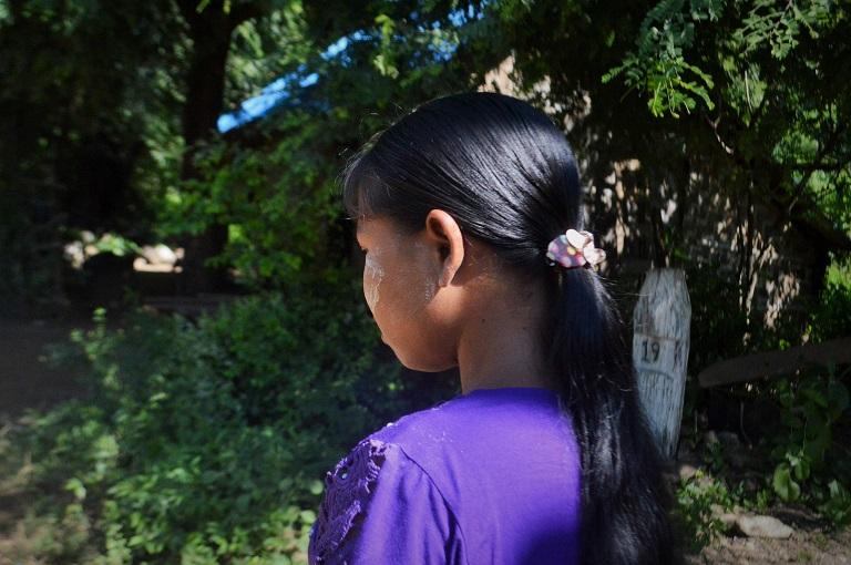 May Thu, an illegal logger in Myanmar who was seriously injured when she fell on a chainsaw. (Poppy McPherson | Mongabay)