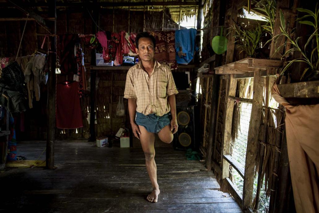 Ko Htun Win lost his left leg to a crocodile in 2018 while setting a fishing net in the waters close to his village of Wae Chaung. (Hkun Lat | Frontier)