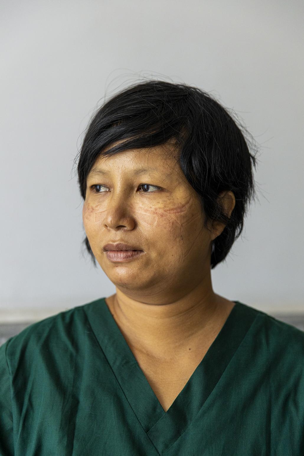 A medical worker, her face still bearing marks from wearing personal protective equipment. (Hkun Lat | Frontier)