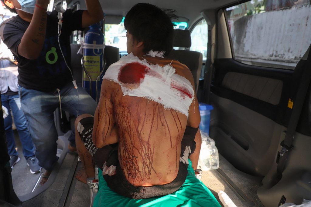 A man injured at an anti-coup demonstration in Mandalay receives medical attention from a volunteer crew on April 1. (AFP)