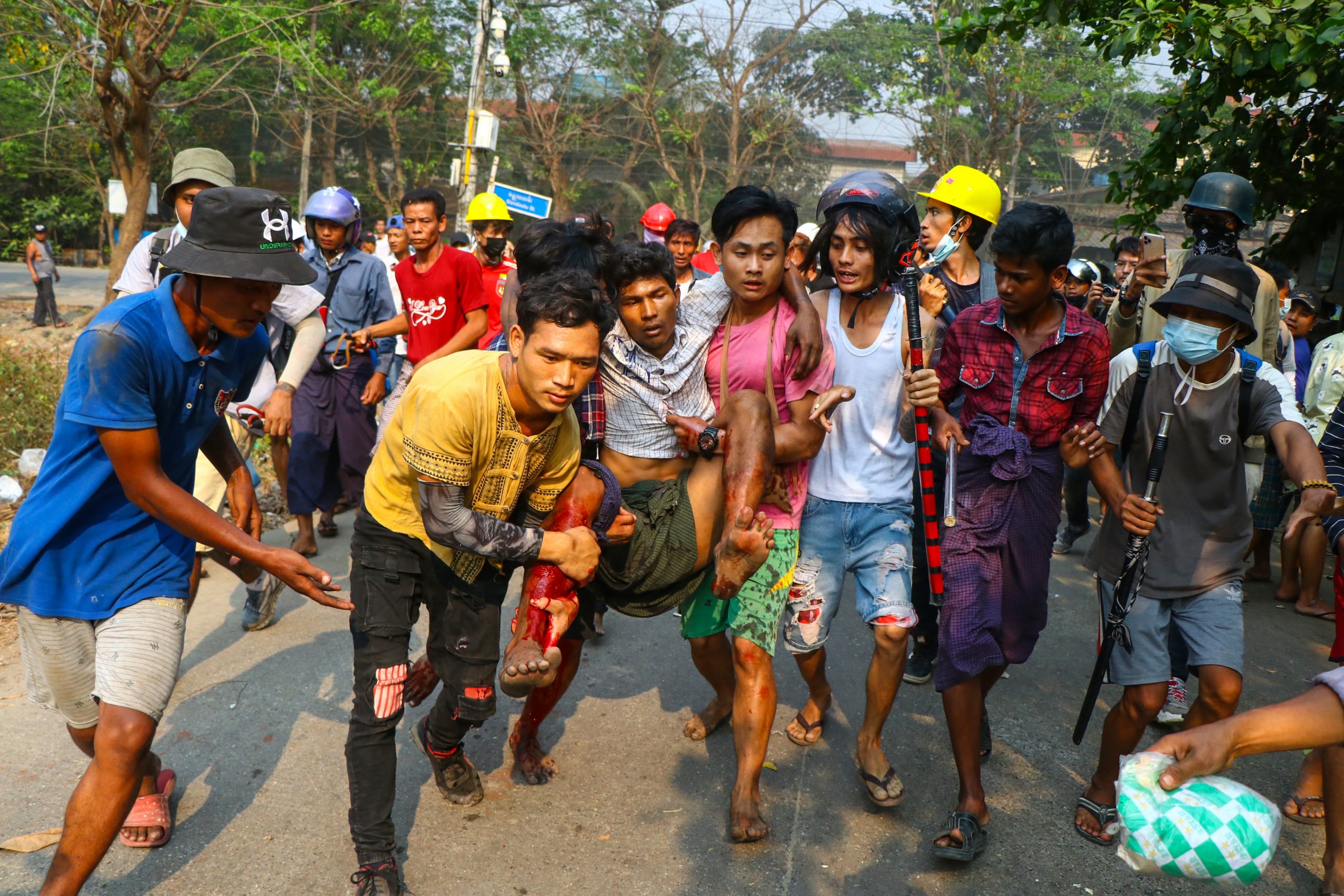 လုံခြုံရေးတပ်ဖွဲ့ဝင်များ၏ ပစ်ခတ်ဖြိုခွင်းမှုကြောင့် ဒဏ်ရာရရှိသွားသူ တစ်ဦးကို ဘေးကင်းရာသို့ ဆန္ဒပြသူများက ခေါ်ဆောင်သွားကြစဉ်။ ယင်းဓာတ်ပုံကို ရန်ကုန်မြို့က ဆန္ဒပြပွဲတစ်ခုတွင် ရိုက်ကူးထားခြင်း ဖြစ်သည်။ (ဓာတ်ပုံ | အေအက်ဖ်ပီ)