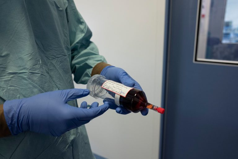 A surgeon holds a syringe prior to administering chemotherapy on June 7, 2019. Many cancer patients in Myanmar are struggling through COVID-19-related income loss and travel restrictions to maintain vital chemotherapy treatments. (AFP)