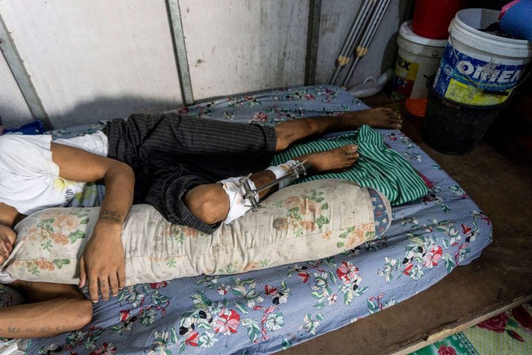 Trishaw rider Ko Maung Win Myo lies in bed at his home in Yangon on May 28. He has been unable to work since he was shot in the leg at an anti-coup protest in March, and has had to seek costly private treatment because he’s too afraid to go to junta-controlled hospitals. (AFP)